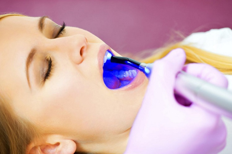 همه آنچه درباره دندانپزشکی با لیزر باید بدانید