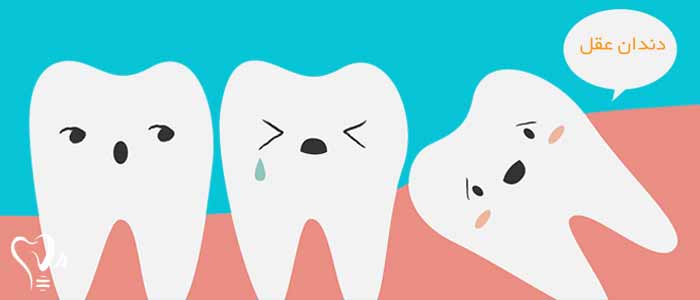 کشیدن دندان عقل بدون درد