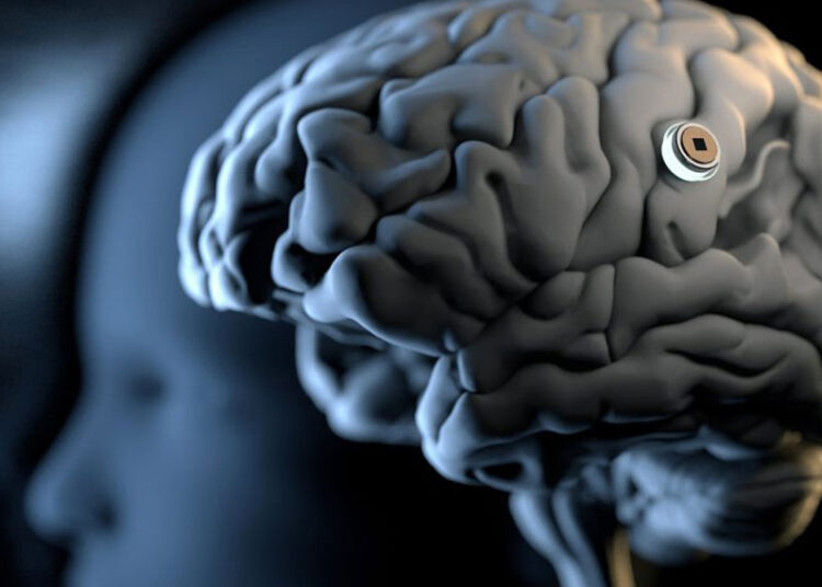 ایلان ماسک از کاشت خودکار تراشه مغزی نورالینک در ۲۰۲۶ خبر داد